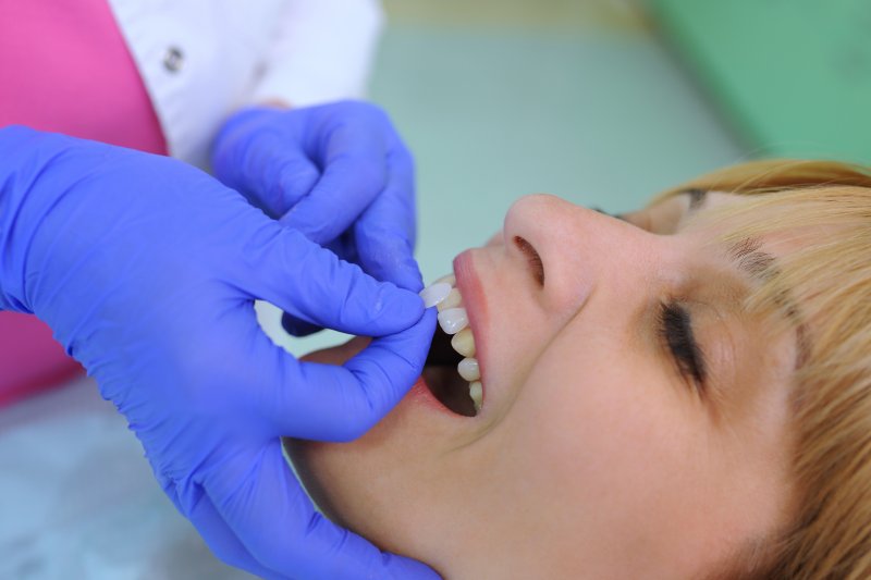 Dentist fits patient for veneers